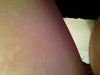 These are on my shoulder.