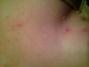 These are on my chest.
