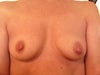 slight assymetry