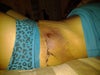 The 23rd of Feb. I bruise easily so Im not surprised this popped up. But it looks terrible!!