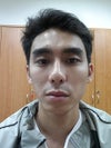 left jaw is more grown than the right. my orthodontist says there is a hot spot on my left jaw.