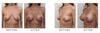 Before and after picture of my desired results