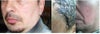before and after