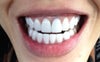 Dark gum tooth