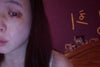 not much to see.  the place where I feel the numbness looks normal