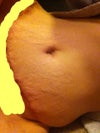 Laying on side, it hangs and does not concave lot other women I see on here