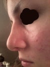 Again, this is post-opt. The dorsal hump should be visible is this picture.