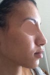 Side profile.