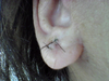 Right earlobe after surgery