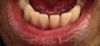 Lower jaw