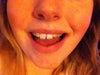 Front teeth.