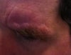Left eyebrow