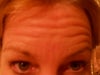 Wrinkly brow
