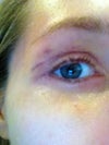 right eye