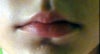 Short top lip