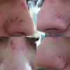 3 weeks after