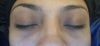 dark circles
