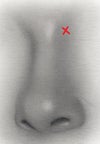 location for injection