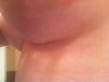 Skin excess, strange shape and sticks out