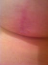 Holding breast up
To show the underneath