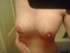 this is exactly one day after my surgery