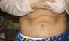 layers of excess skin, standing, just slightly leaned forward taking my own picture