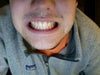It's hard to see because of the camera but my two top front teeth is not aligned with the bottom two and with the middle of my face.