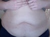 Front view of my abdomen