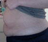 Side view of my abdomen