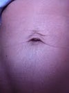Close up of the belly button area. The skin under the navel is actually toned and not a concern, the stretch marks, while noticeable in this shot are barely visible most of the time.