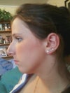 Before profile