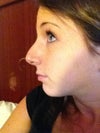 After profile