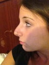 After profile