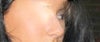 before profile