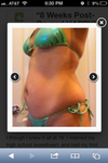 Pre-surgery. 133 lbs.