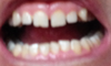 Dental Situation Photo