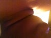 Lipo under chin