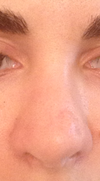 anterior view