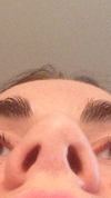 inferior to superior view