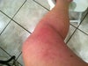 inside left leg