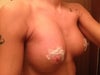 Side of right breast