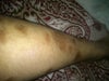 left leg
