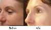 Portrait Before and After Photos