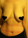 Here is me now, I had salines for 10 years over the muscle. I have very thin skin on left breast but I have a good amount of tissue otherwise. I did have some rippling when I laid down on my right side with saline, but they were big and over the muscle. I am planning on getting under the muscle and not over 300cc this time.