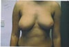 Before any surgery