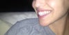no gum showing
