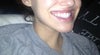 gum showing