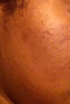 Cheek 1