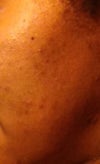 Cheek 2