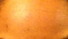 Forehead, nothing serious just want perfect skin